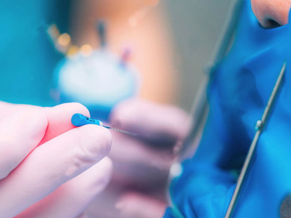 Dentap - Clínica Dentária - Edodontia