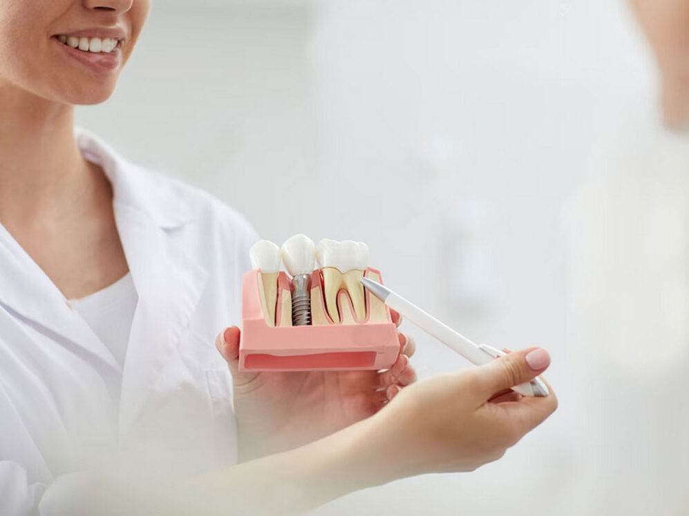 Dentap - Clínica Dentária - Implantologia