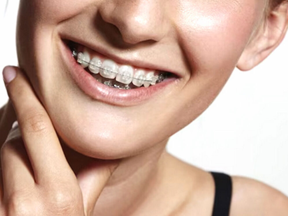 Dentap - Clínica Dentária - Ortodontia