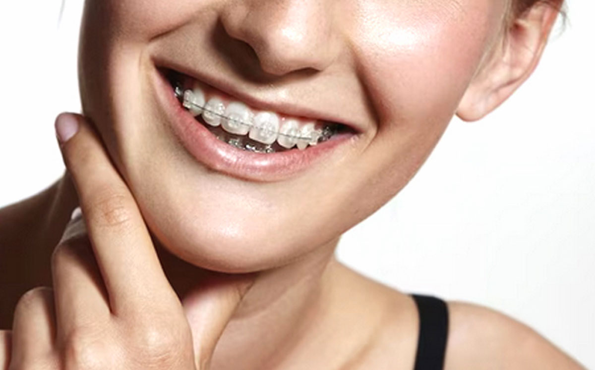 Dentap - Clínica Dentária - Ortodontia