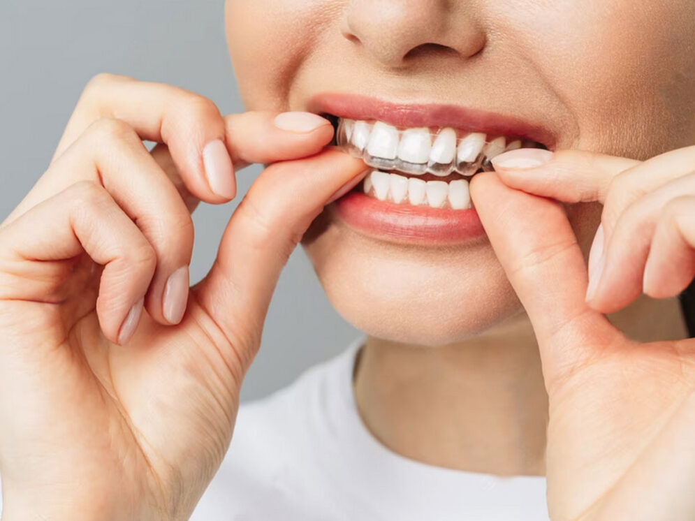 Dentap - Clínica Dentária - Ortodontia