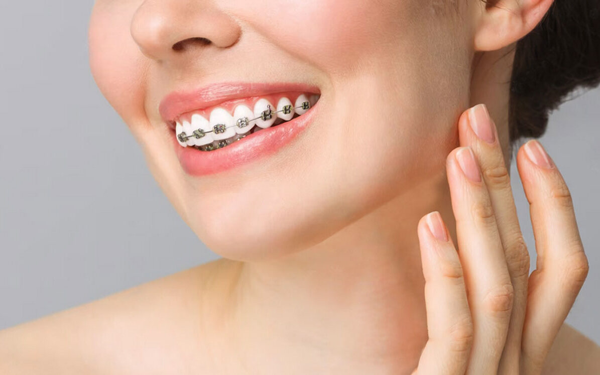 Dentap - Clínica Dentária - Ortodontia