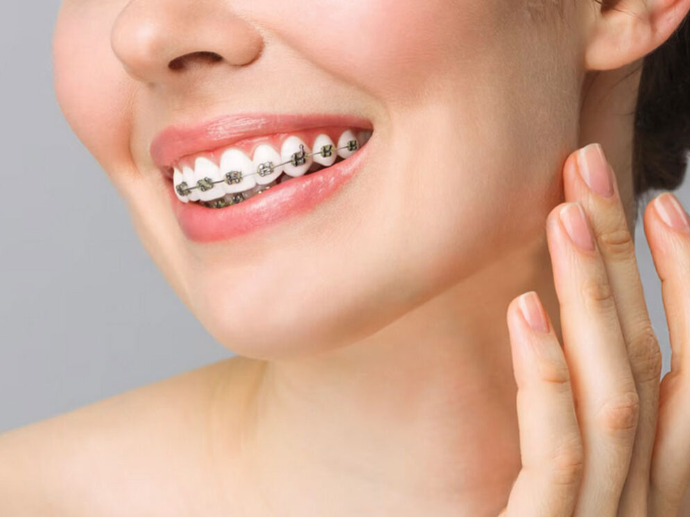 Dentap - Clínica Dentária - Ortodontia