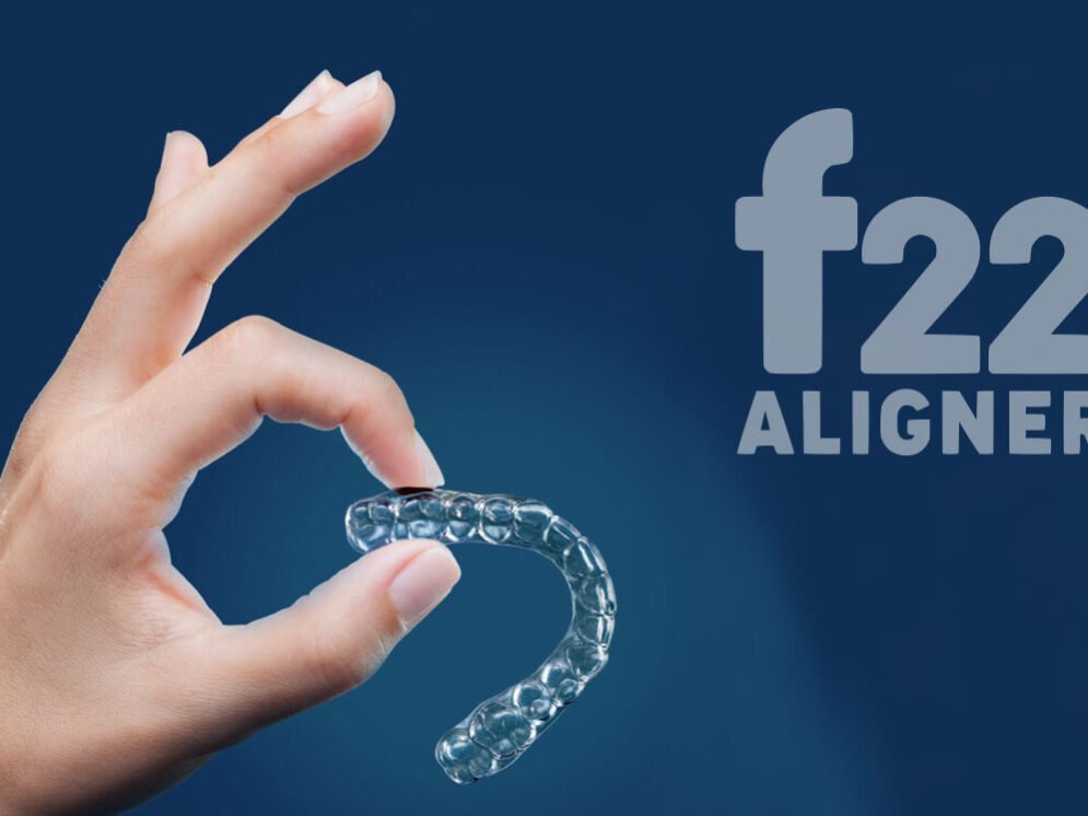 F22 aligner