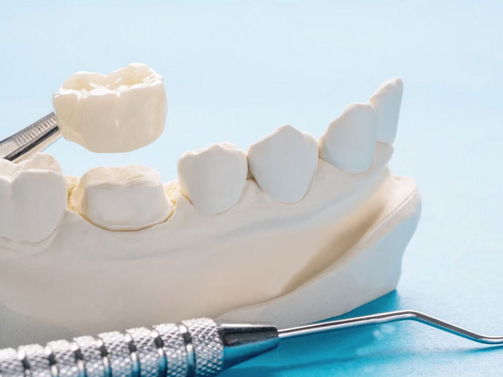 Dentap - Clínica Dentária - Reabilitação