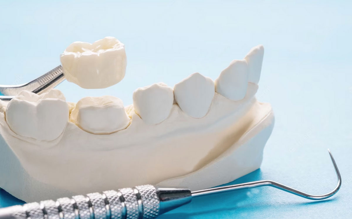 Dentap - Clínica Dentária - Reabilitação